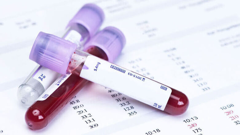 Ελληνικός Ερυθρός Σταυρός: Δωρεάν προληπτικοί έλεγχοι για HIV, ηπατίτιδα και σύφιλη στην Πλατεία Συντάγματος