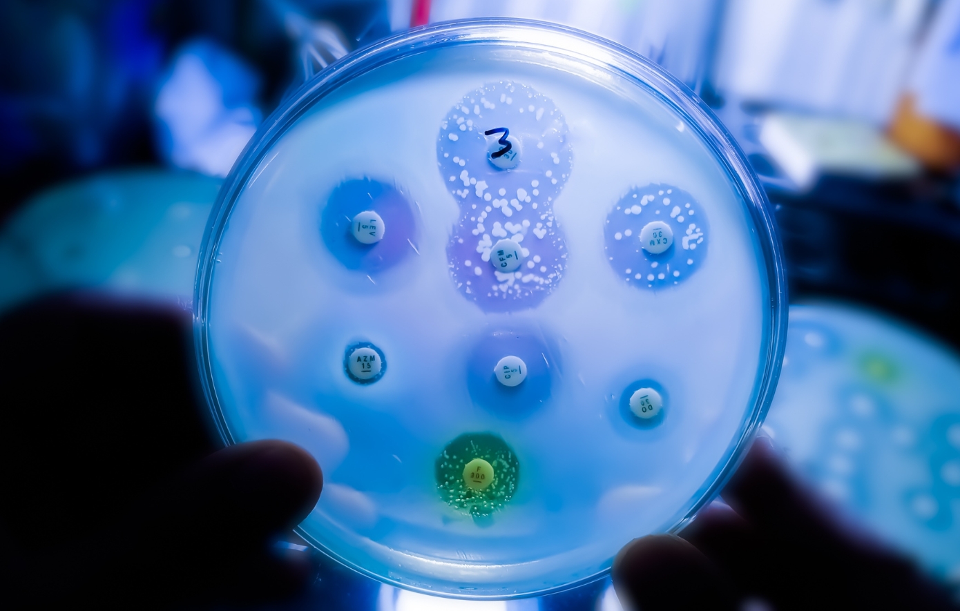 Η αντοχή στα αντιβιοτικά μας απειλεί όλους – Τι πρέπει να κάνετε