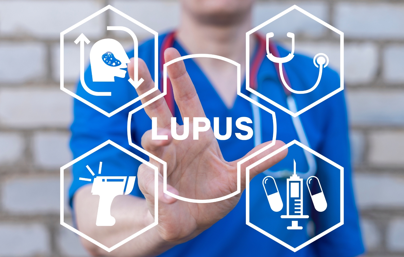 Επιστήμονες συσχέτισαν τον ερυθηματώδη λύκο με έναν από τους πιο κοινούς ιούς παγκοσμίως