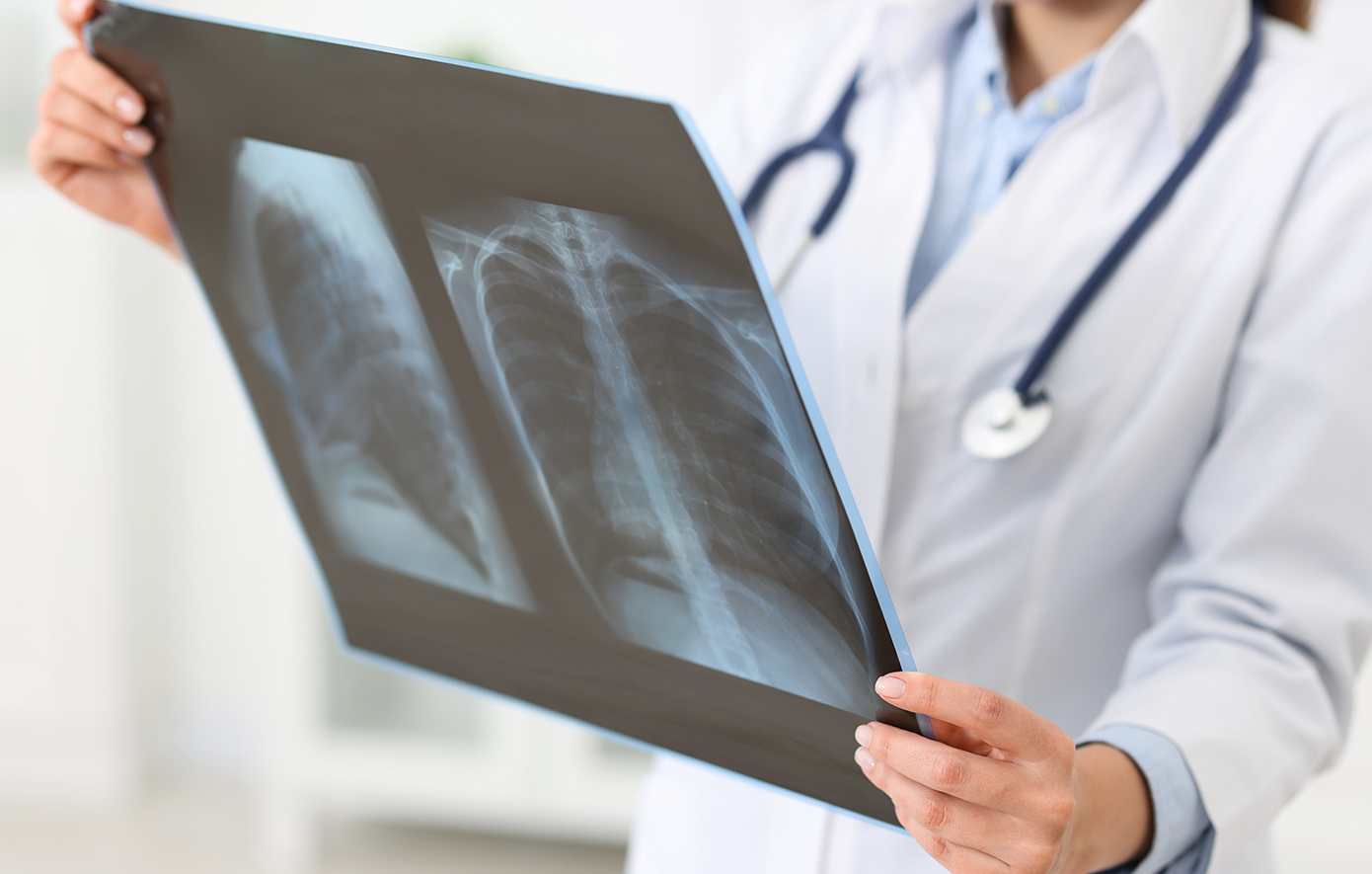 Η πρώτη αιτία θανάτου από μολυσματική νόσο  που σκότωσε 1,23 εκατ. ανθρώπους το 2024