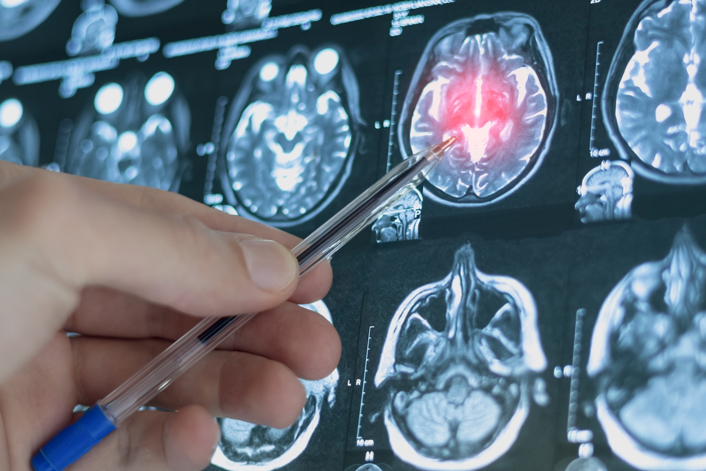 Το καλύτερο σνακ για την ενίσχυση της μνήμης και της λειτουργίας του εγκεφάλου