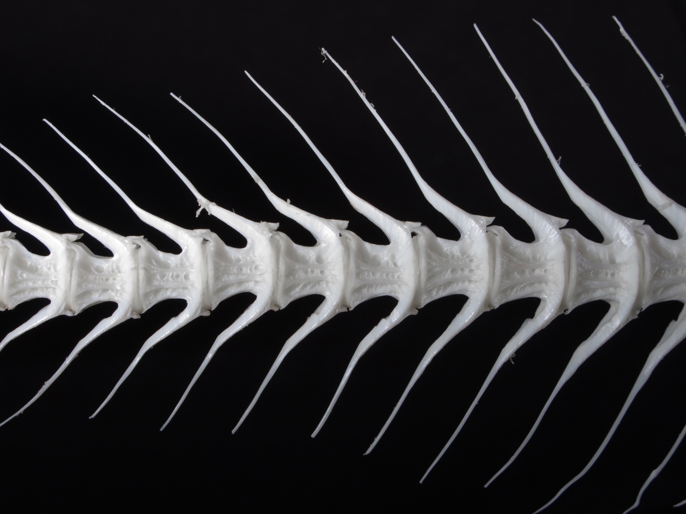 Δεν κινδυνεύετε μόνο να σας κάτσει στον λαιμό – Οι κίνδυνοι αν καταπιείτε κόκαλο ψαριού και τι μπορείτε να κάνετε