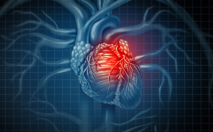Χειρουργική στεφανιαίων αγγείων με πάλλουσα καρδιά
