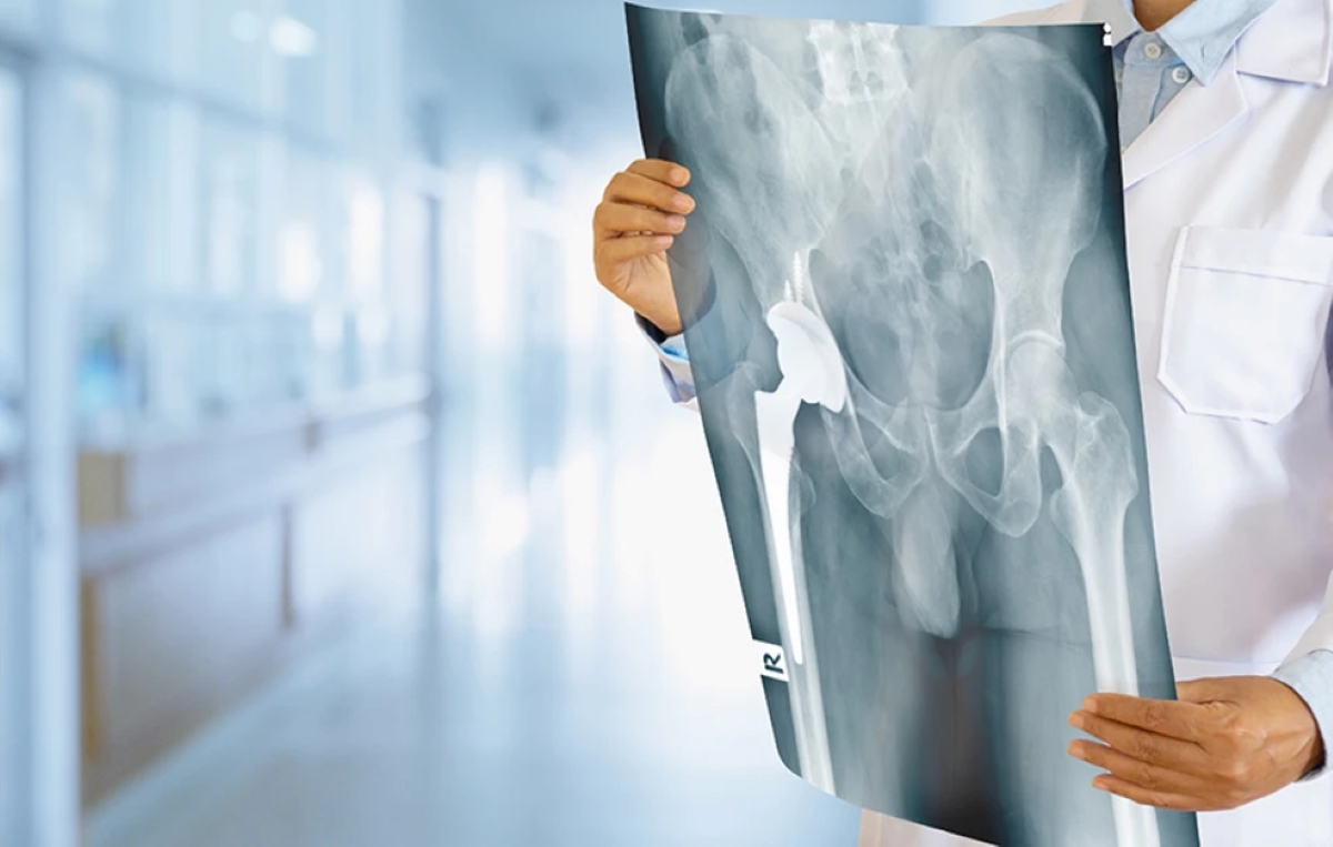 Ο μαγικός συνδυασμός θρεπτικών συστατικών για υγιή και δυνατά οστά