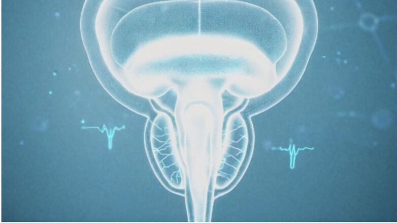 Eντοπισμένος καρκίνος του προστάτη: Η διάρκεια της ορμονοθεραπείας πρέπει να εξατομικεύεται προσεκτικά