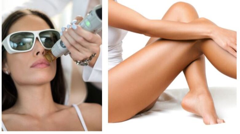 Laser Αποτρίχωση με Αλεξανδρίτη – Δερματολογικά Ιατρεία CITY MED