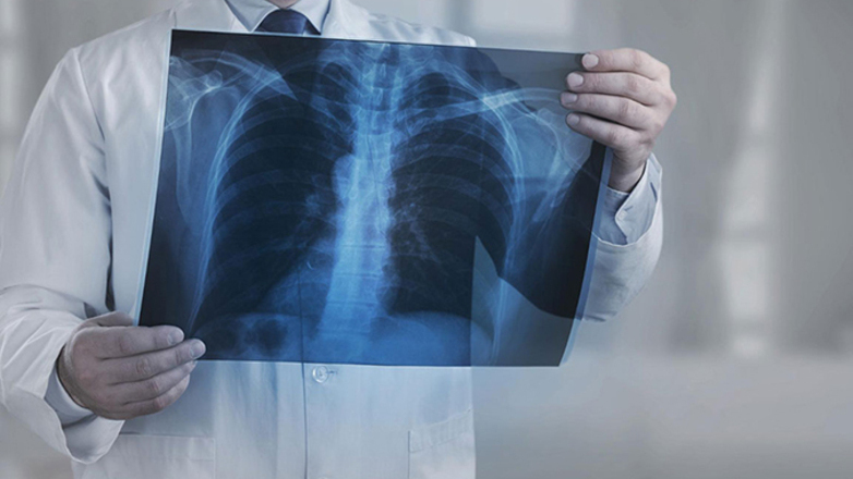 Νωτιαία μυϊκή ατροφία: Η Biogen έλαβε έγκριση από την ΕΕ για το σχήμα υψηλής δόσης του nusinersen